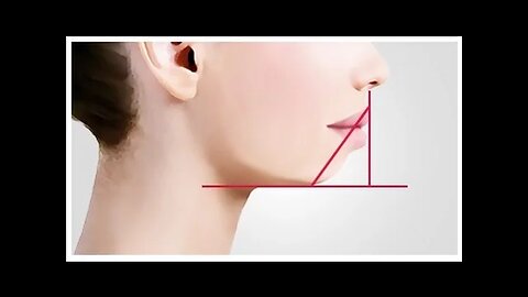 What Is A Recessive Chin By Dr Mike Mew