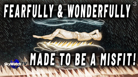 THE MYSTERIOUS REASONS GOD FEARFULLY & WONDERFULLY MAKES SOME PEOPLE "MISFITS"