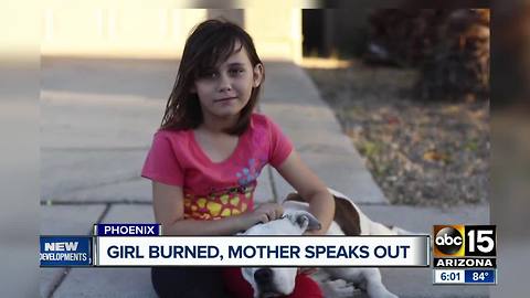 Mother speaks out after her daughter was severely burned