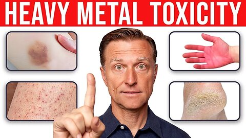 Identifying Heavy Metal Toxicity From Your Skin