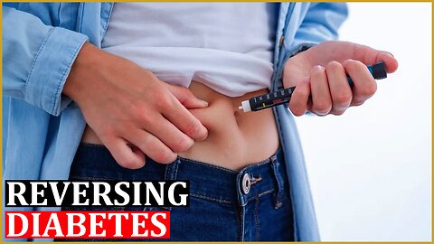 E10 - Reversing Type 2 Diabetes: Here's How
