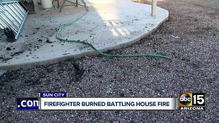 Firefighter injured while battling Sun City house fire