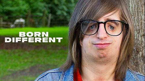 Bullied For Being Born Without Ears Or Cheekbones | BORN DIFFERENT