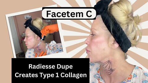 Facetem C - Radiesse Dupe for a More Youthful Neck