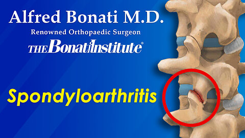 Spine Surgeon discusses Spondyloarthritis