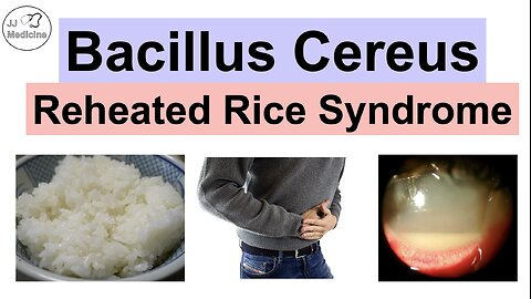 Bacillus Cereus (Reheated Rice Syndrome) Food Poisoning, Symptoms, Diagnosis, Treatment