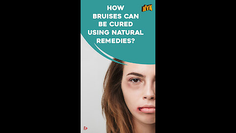 How To Get Rid Of Bruises Using Natural Remedies *