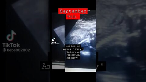 Allegedly FAKE ultrasound posted on #AmberWaterman aka Lucy's PERSONAL ACCOUNT