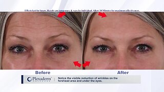 Reduce Under-Eye Bags and Wrinkles