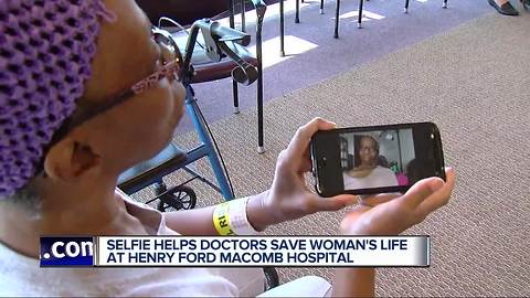 Selfie helps doctors save metro Detroit woman's life