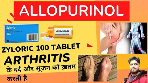 ZYLORIC 100 | ALLOPURINOL | ARTHRITIS PAIN | दर्द और सूजन से राहत | USE | SIDEE FFECTS हिंदी में