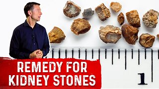 The Great Remedy to Prevent Kidney Stones – Dr. Berg