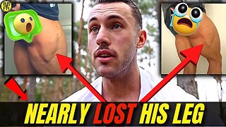 Brandon Harding will ruin his career | Brandon Harding || Steroids are ruining his health.