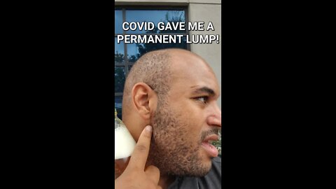 Covid vaccine gave me a permanent neck lump #shorts