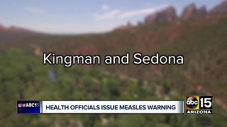 Health officials warn of potential measles exposure in northern Arizona