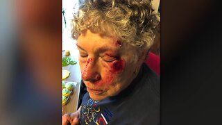 69-year-old grandma recovering after being mugged at Pick 'n Save in Milwaukee