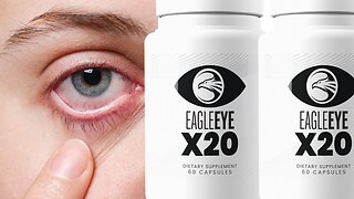 EAGLE EYE X20 REVIEW - EAGLE EYE X20 WORK? EAGLE EYE X20 2022