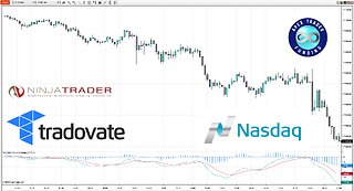 Live Scalp Trade: Turning $150+ Profits in Minutes | MNQ Futures