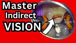 Master Indirect Vision - One of the Hardest Beginner Dental Skills