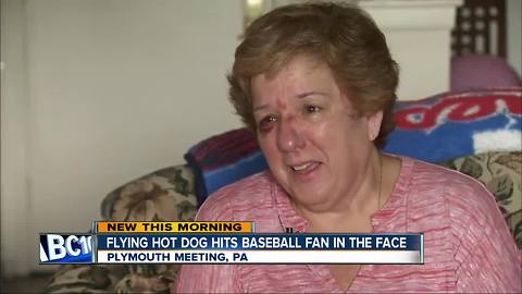 Fan struck by flying hot dog during baseball game