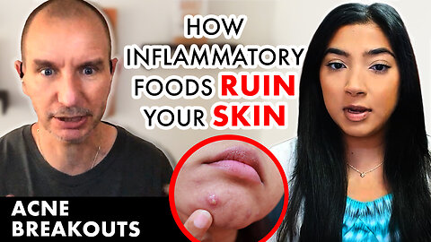 ⚠️ Long Term Risks of Ignoring Acne 😱 Gut & Skin Connection! From Acne to Wellness 🔥