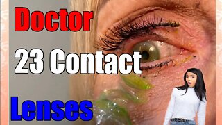 Doctor removes 23 contact lenses from eye of patient
