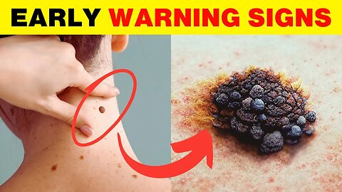 Visit Doctor Right Now if You Have These 12 Early Warning Signs of Cancer | Natural Cures