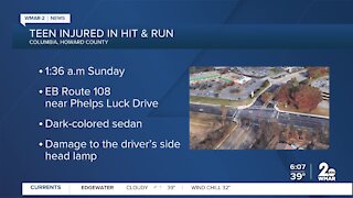 Teen injured in Columbia hit & run