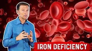 Iron Deficiency – Functions, Symptoms, & Causes Explained By Dr. Berg