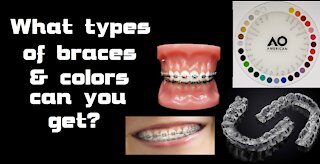 What types of braces & colors can you get?