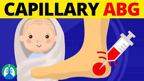 Puncture Site for a Capillary Blood Sample in Infants (TMC Practice Question)