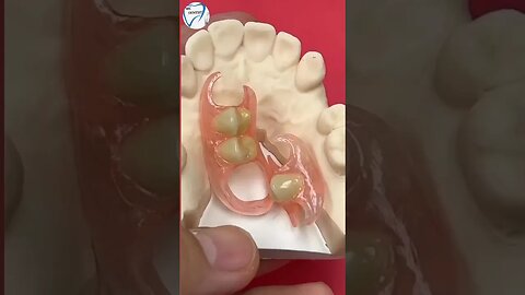 Two unilateral flexi partials Dental