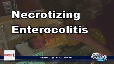 Necrotizing Enterocolitus: A disease in premature babies