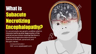 ( -0423 ) Confirmed Necrotizing Encephalitis From the mRNA Covid-19 Jab (A Study By Michael Morz. Clearly We're Being Mistreated )