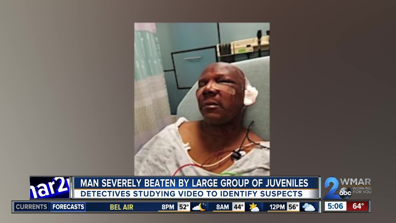 Man walking home badly beaten, robbed by large group of juveniles
