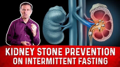 How to Prevent Kidney Stones on Intermittent Fasting (if you are susceptible) – Dr. Berg