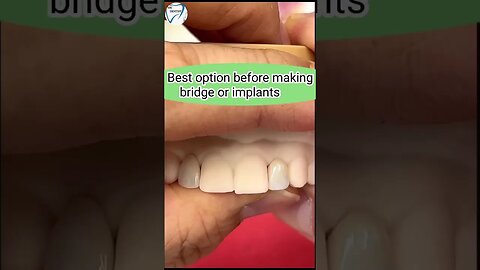 Great option before making Bridge or implants Dental