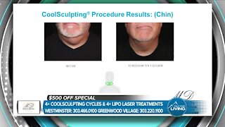 MD Body & Med Spa // Targeted Coolsculpting!