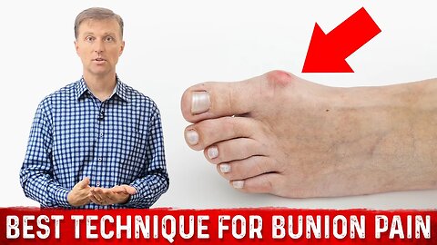 Bunion Pain Relief – The Simple & Best Technique by Dr.Berg
