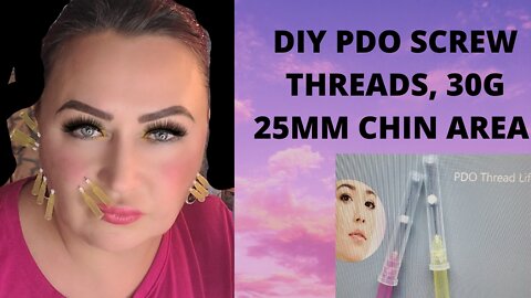 PDO THREADS 30G 25 MM @ home PICS BEFORE/ AFTER VLOG #14 #pdothreads #threadlift