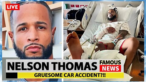 MTV's Nelson Thomas Shares Photos From Car Accident That Nearly Took His Life | Famous News