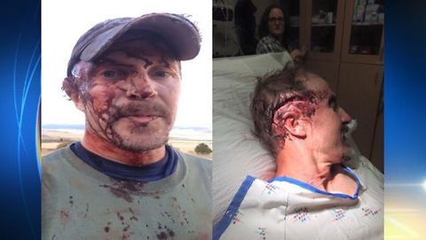 Man Attacked By Mother Grizzly, Survives, Drives To Hospital