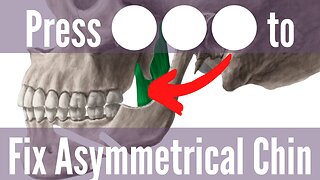 Relax Jaw Sliding Muscle To Fix Asymmetrical Chin
