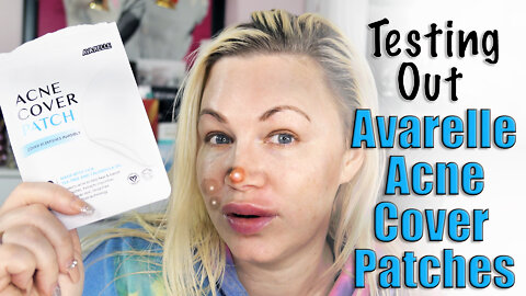 Testing out Avarelle Acne Cover Patches | Code Jessica10 saves you 10% off