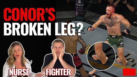 WOW!! Conor McGregor's Broken Leg Injury | UFC 264