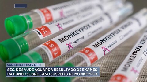 S. do Paraíso: Sec. de Saúde aguarda resultado de exames da FUNED sobre caso suspeito de Monkeypox.