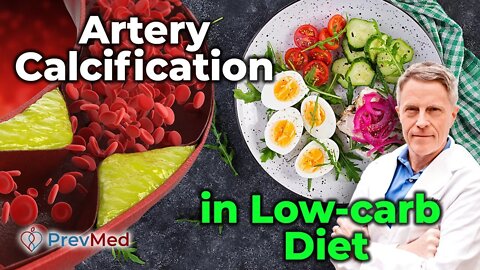 Does Low-carb Diet cause artery calcification?