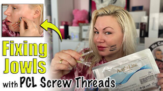 Fixing Jowls with PCL Screw threads from AceCosm.com | Code Jessica10 Saves you Money!