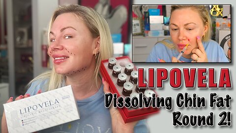 Lipovela, Fat Dissolver to Contour my Face: Round 2! Maypharm.net, Code Jessica10 saves you Money