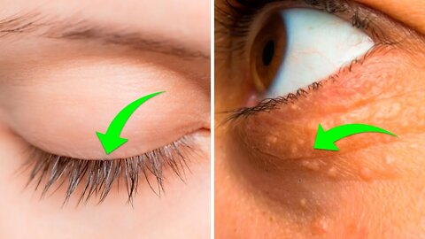 9 COISAS QUE SEUS OLHOS PODEM DIZER SOBRE SUA SAÚDE